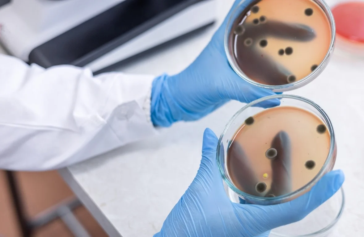 Professional vs. DIY Mold Testing: What You Should Know